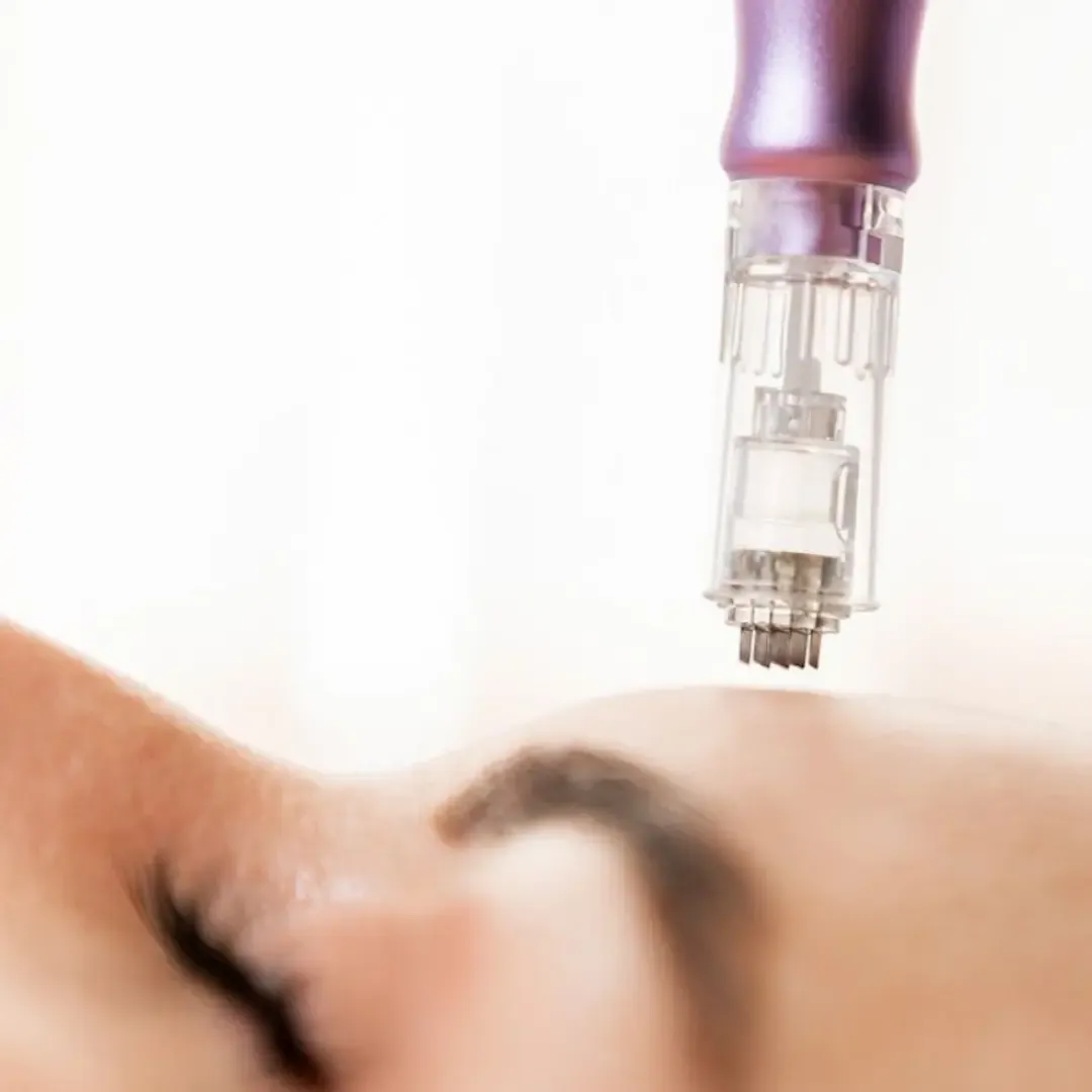 Microneedling + PDRN/PN Repair