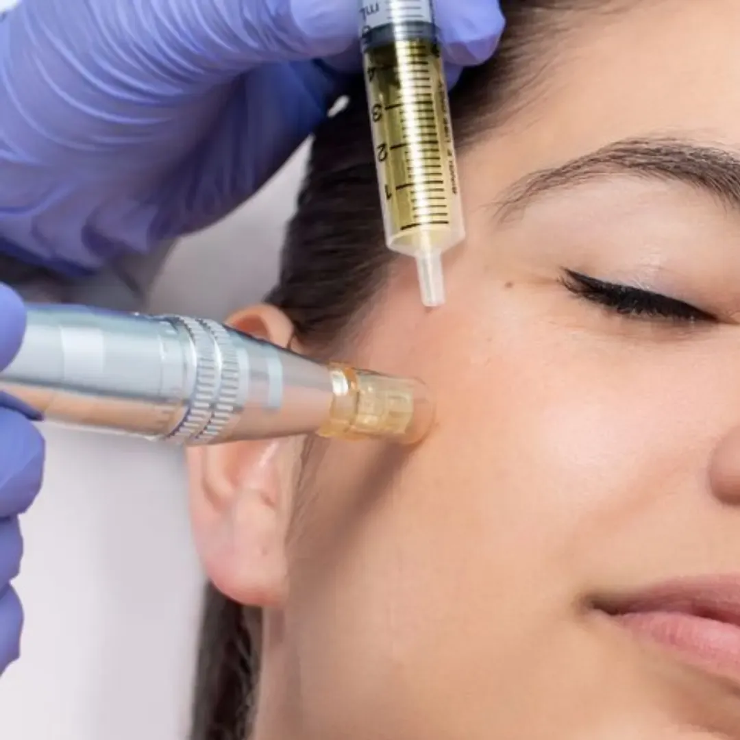 Microneedling + Exosome Boost
